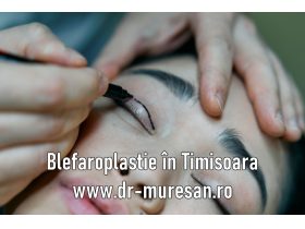 Oferta, National, Blefaroplastia in Timisoara rejuvenare 10 ani de tinerete